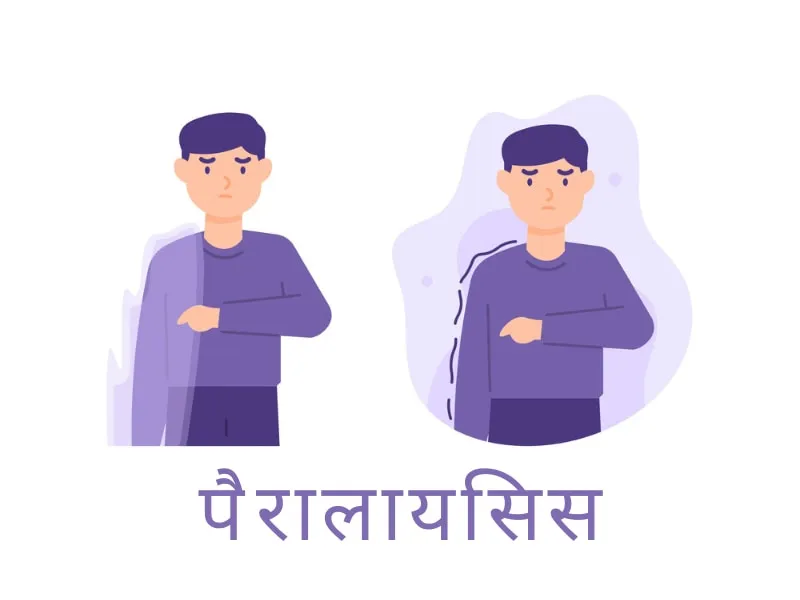 paralysis होने के कारण और निदान