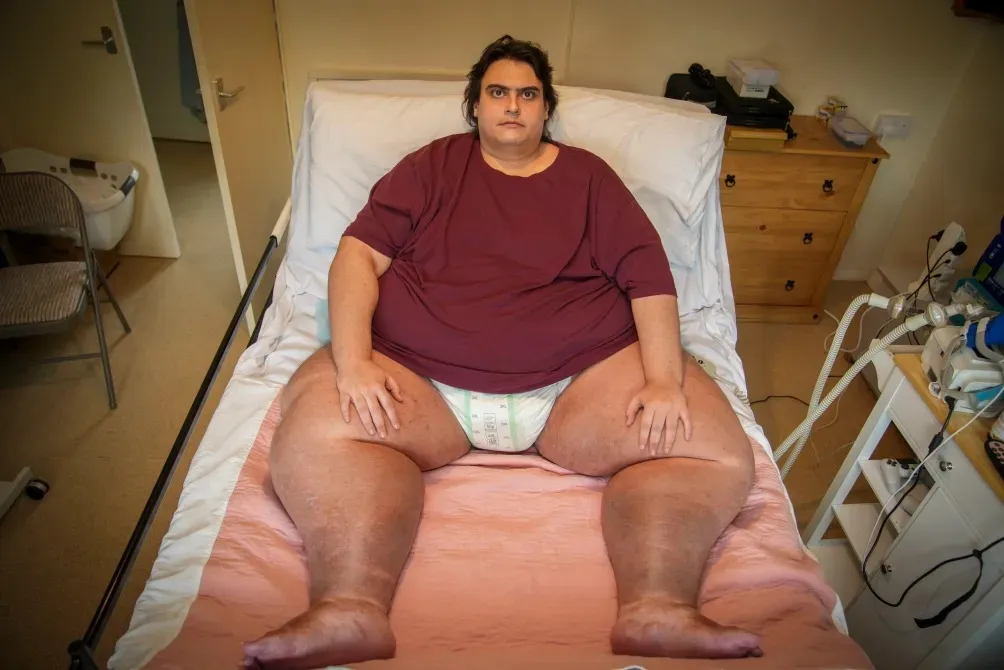 Zoo में हुआ युवक का एक्स-रे