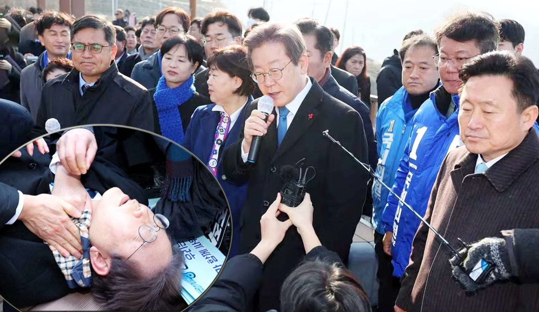 journalists से बात करने के दौरान विपक्षी नेता को चाकू से घायल ‎किया