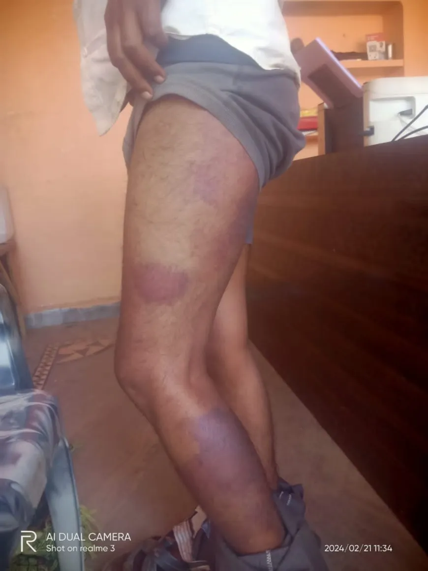 युवक को चौकी में बंद कर मारपीट किए जाने का मामला