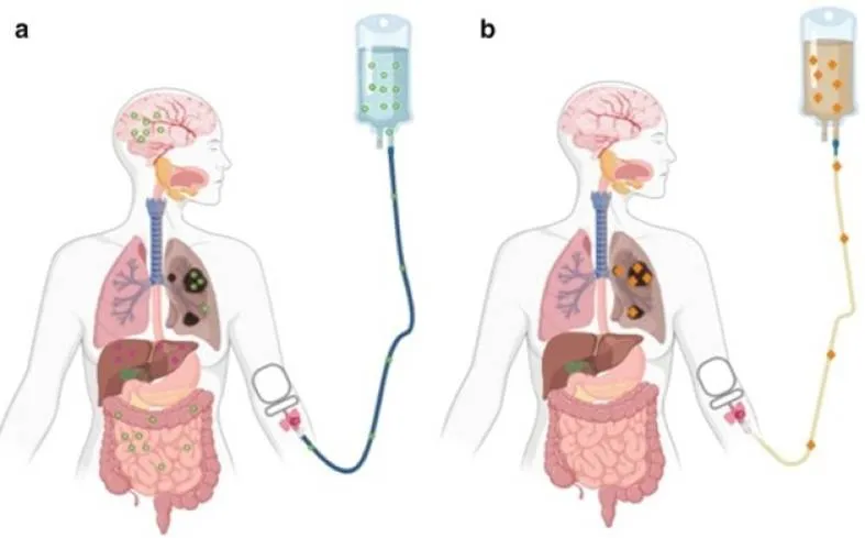 Chemotherapy और टारगेटेड थेरेपी से बड़ी आंत का कैंसर होगा ठीक
