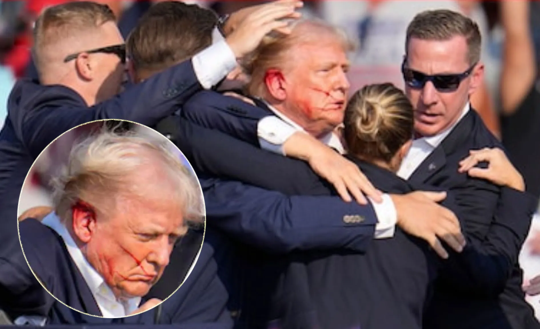 गोलीबारी में Trump घायल, हमलावर मारा गया