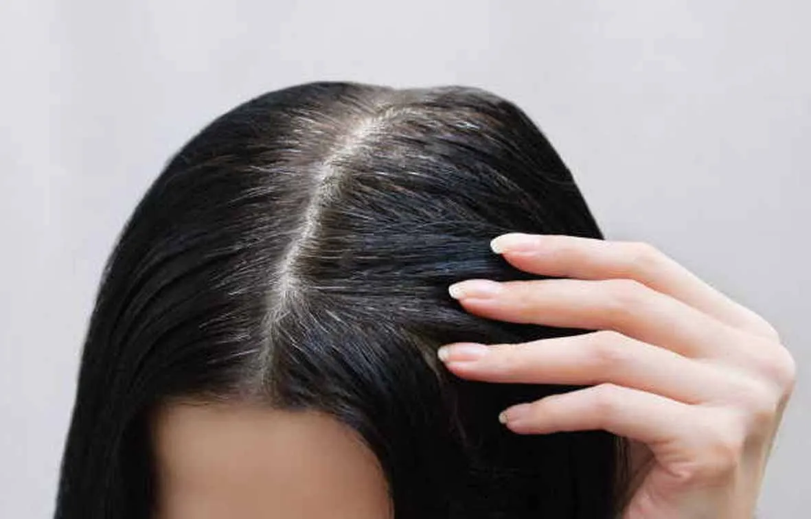 White Hair इस प्रकार होंगे काले